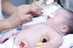 overventilation birth injury 