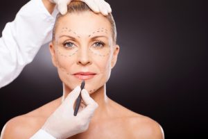 Medical malpractice for plastic surgery in Michigan