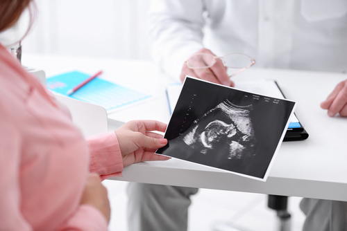 birth defect birth injury negligence